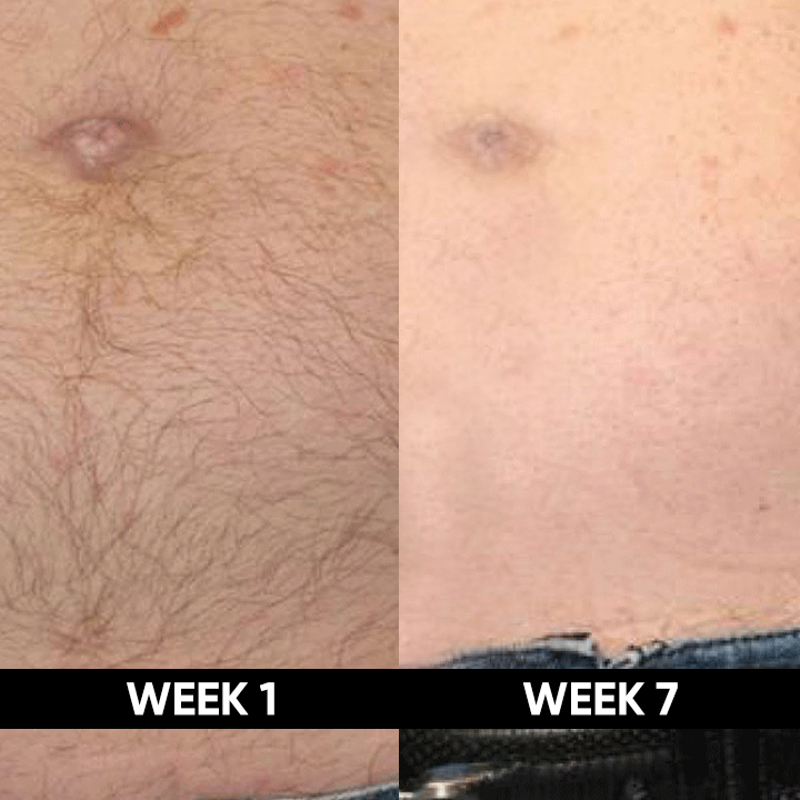 testomonial-difrrence-3-1.jpg